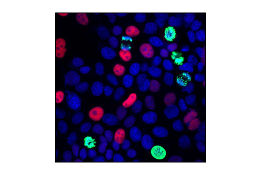 Immunofluorescence Image 1: p21 Waf1/Cip1 (12D1) Rabbit mAb