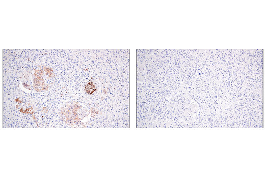 Immunohistochemistry Image 1: Enolase-2 (E2H9X) XP® Rabbit mAb (BSA and Azide Free)