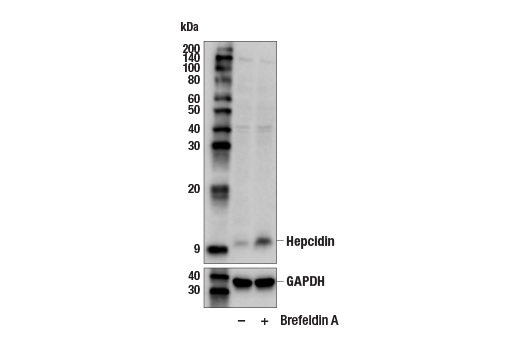 Western Blotting Image 2: Hepcidin (E8M5B) Rabbit mAb