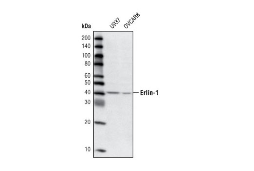 Western Blotting Image 1: Erlin-1 Antibody