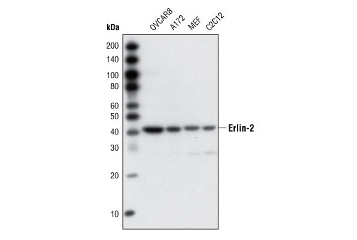 Western Blotting Image 1: Erlin-2 Antibody