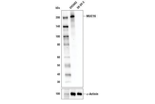 Western Blotting Image 1: MUC16 Antibody
