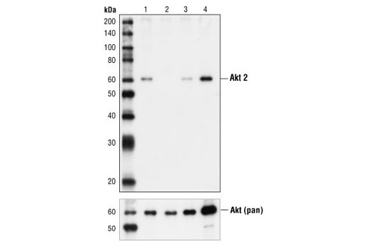 Western Blotting Image 3: Akt2 Antibody