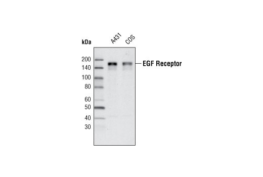 Western Blotting Image 1: EGF Receptor (T43) Antibody