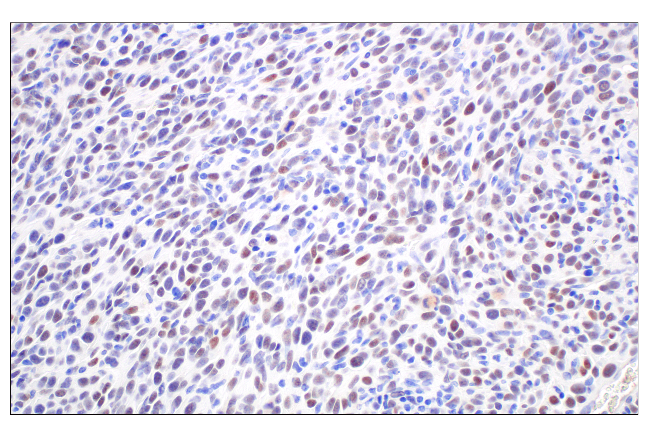 Immunohistochemistry Image 4: FOXG1 (E2W8P) Rabbit mAb