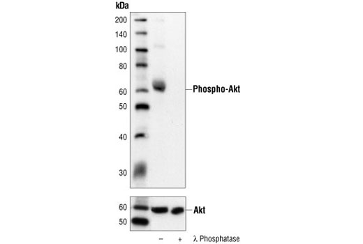 Western Blotting Image 1: Phospho-Akt (Tyr326) Antibody