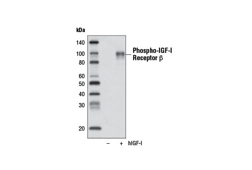 Western Blotting Image 1: Phospho-IGF-I Receptor β (Tyr1135/1136)/Insulin Receptor β (Tyr1150/1151) (19H7) Rabbit mAb (Biotinylated)