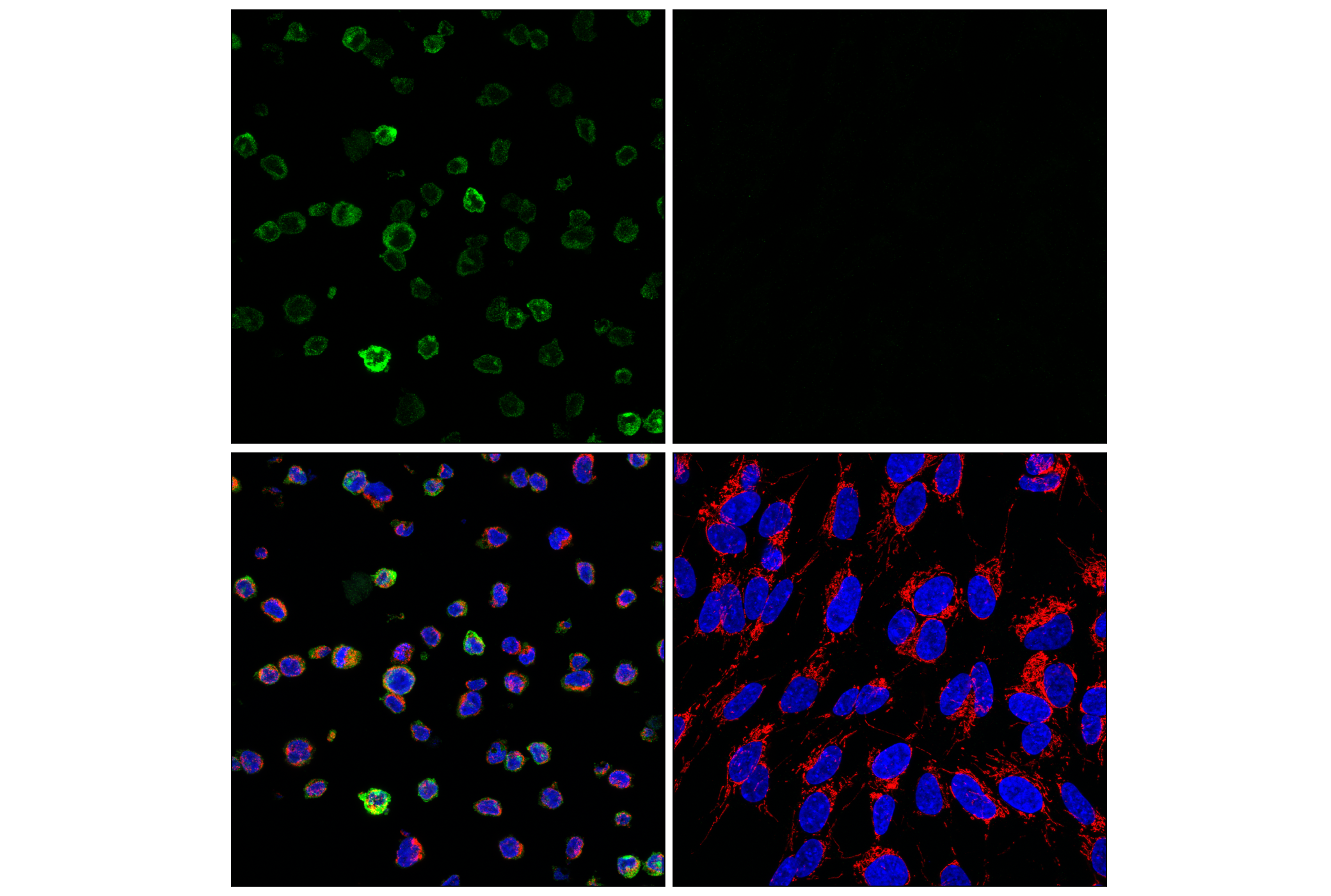 Immunofluorescence Image 1: TREM2 (E4F5G) Mouse mAb