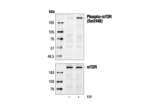 Western Blotting Image 1: Phospho-mTOR (Ser2448) Antibody