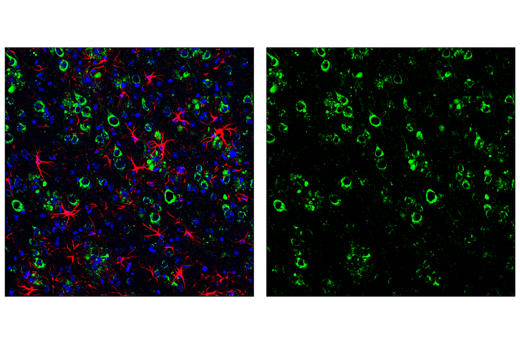 Immunofluorescence Image 2: APP (E5X2B) Rabbit mAb