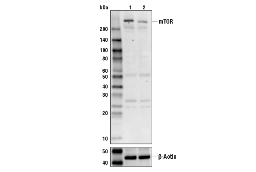Western Blotting Image 1: mTOR Antibody