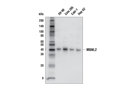 Western Blotting Image 1: MBNL2 Antibody
