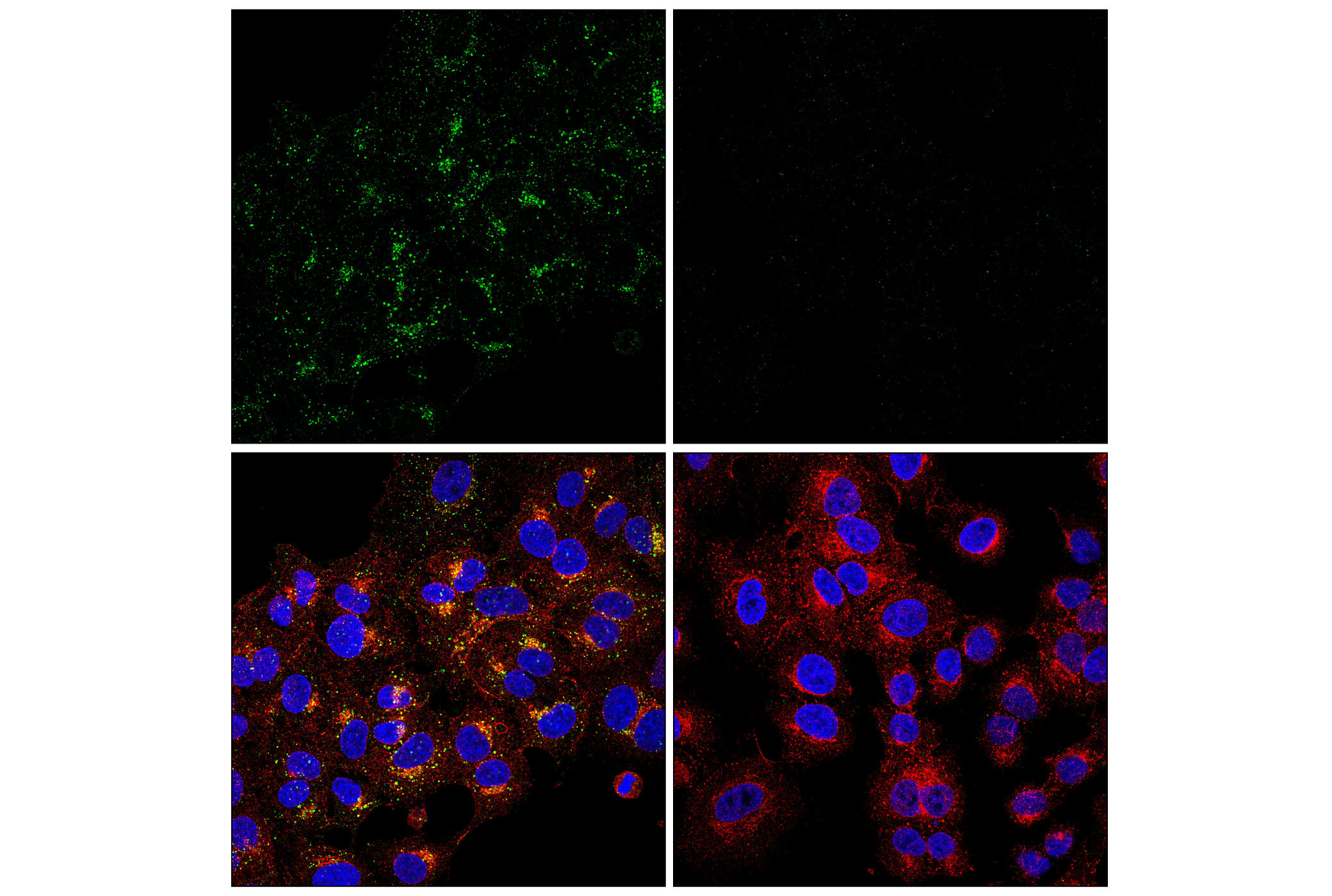 Immunofluorescence Image 1: APP (E8B3O) XP® Rabbit mAb