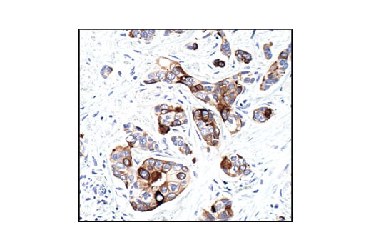 Immunohistochemistry Image 2: Phospho-mTOR (Ser2448) (49F9) Rabbit mAb