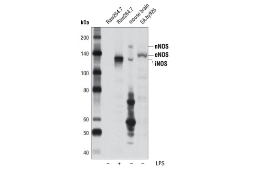 Western Blotting Image 1: NOS (pan) Antibody