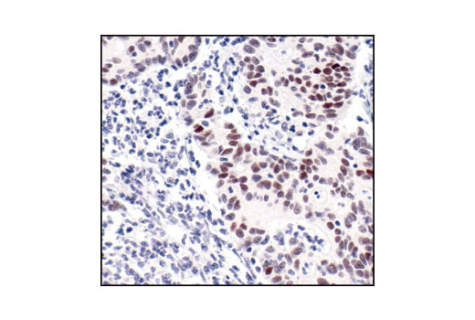 Immunohistochemistry Image 1: Cyclin D1 (92G2) Rabbit mAb