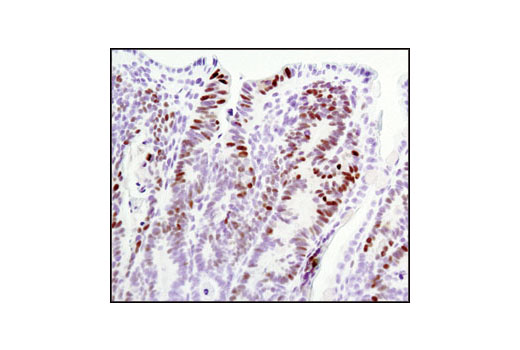 Immunohistochemistry Image 2: Cyclin D1 (92G2) Rabbit mAb
