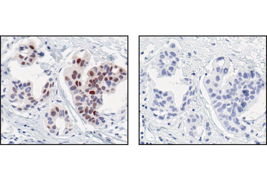Immunohistochemistry Image 3: Cyclin D1 (92G2) Rabbit mAb