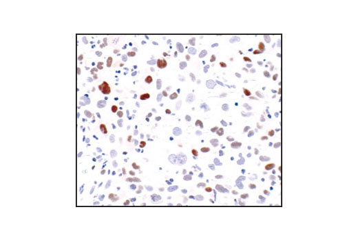 Immunohistochemistry Image 4: Cyclin D1 (92G2) Rabbit mAb