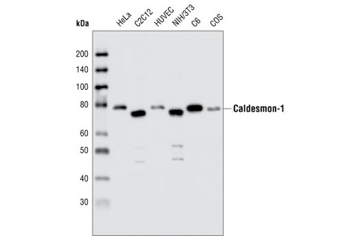 Western Blotting Image 1: Caldesmon-1 Antibody