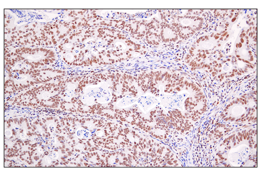 Immunohistochemistry Image 1: DEK (E4S5J) Rabbit mAb