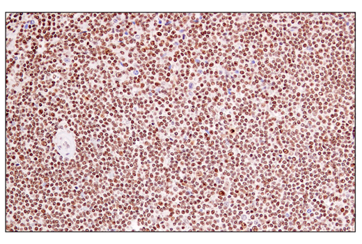 Immunohistochemistry Image 3: DEK (E4S5J) Rabbit mAb