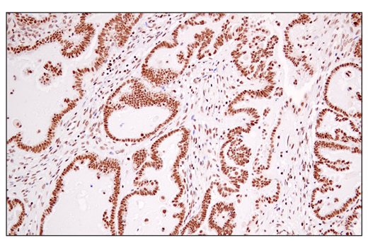 Immunohistochemistry Image 5: DEK (E4S5J) Rabbit mAb