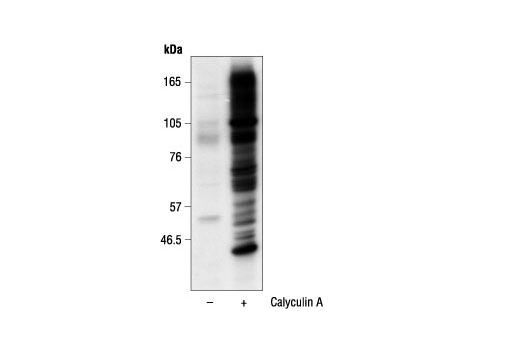  Image 2: Phospho-(Ser) Kinase Substrate Antibody Sampler Kit