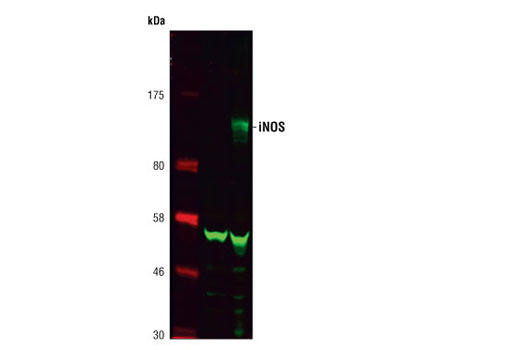Western Blotting Image 2: iNOS Antibody