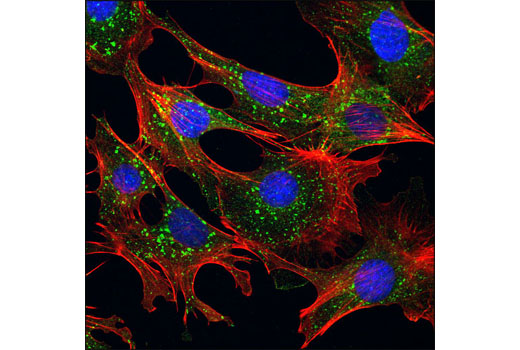 Immunofluorescence Image 1: mTOR (7C10) Rabbit mAb