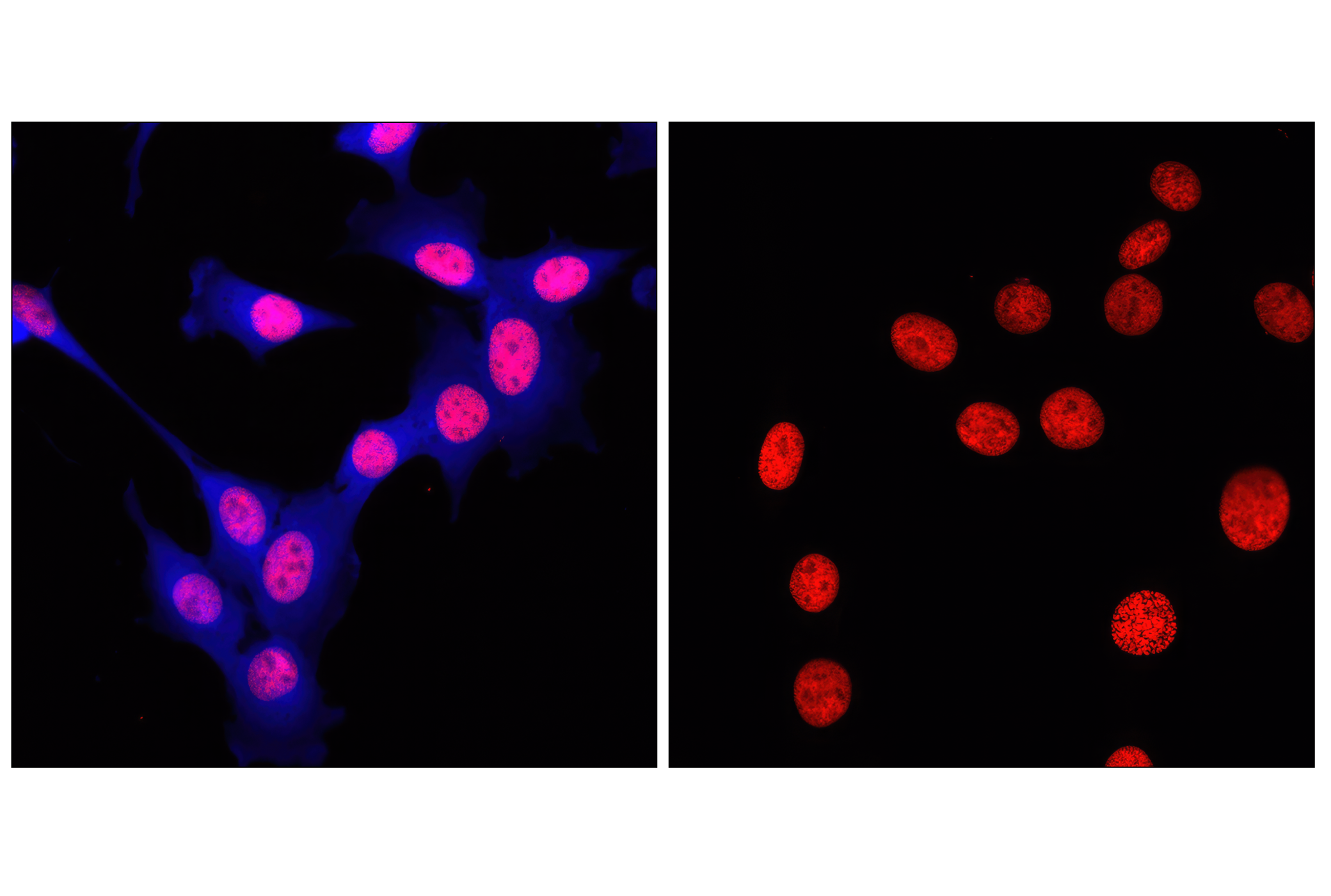 Immunofluorescence Image 1: Rabbit (DA1E) mAb IgG XP® Isotype Control (Alexa Fluor® 647 Conjugate)
