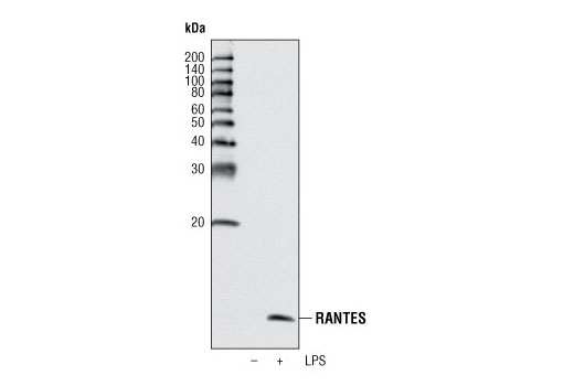 Western Blotting Image 1: CCL5/RANTES (R40) Antibody