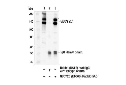 Immunoprecipitation Image 1: GUCY2C (E1Q6S) Rabbit mAb