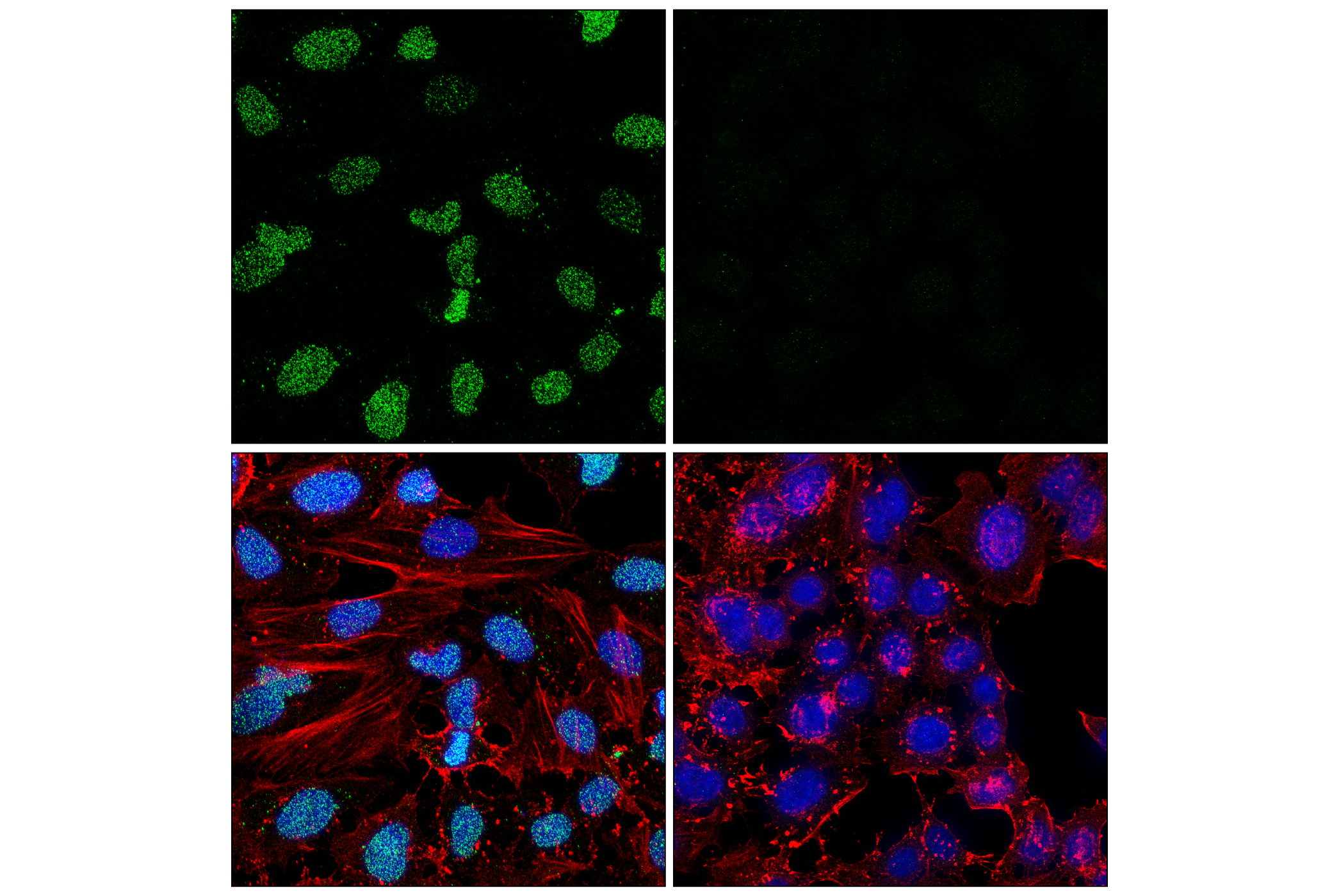 Immunofluorescence Image 2: Poly/Mono-ADP Ribose (D9P7Z) Rabbit mAb (BSA and Azide Free)