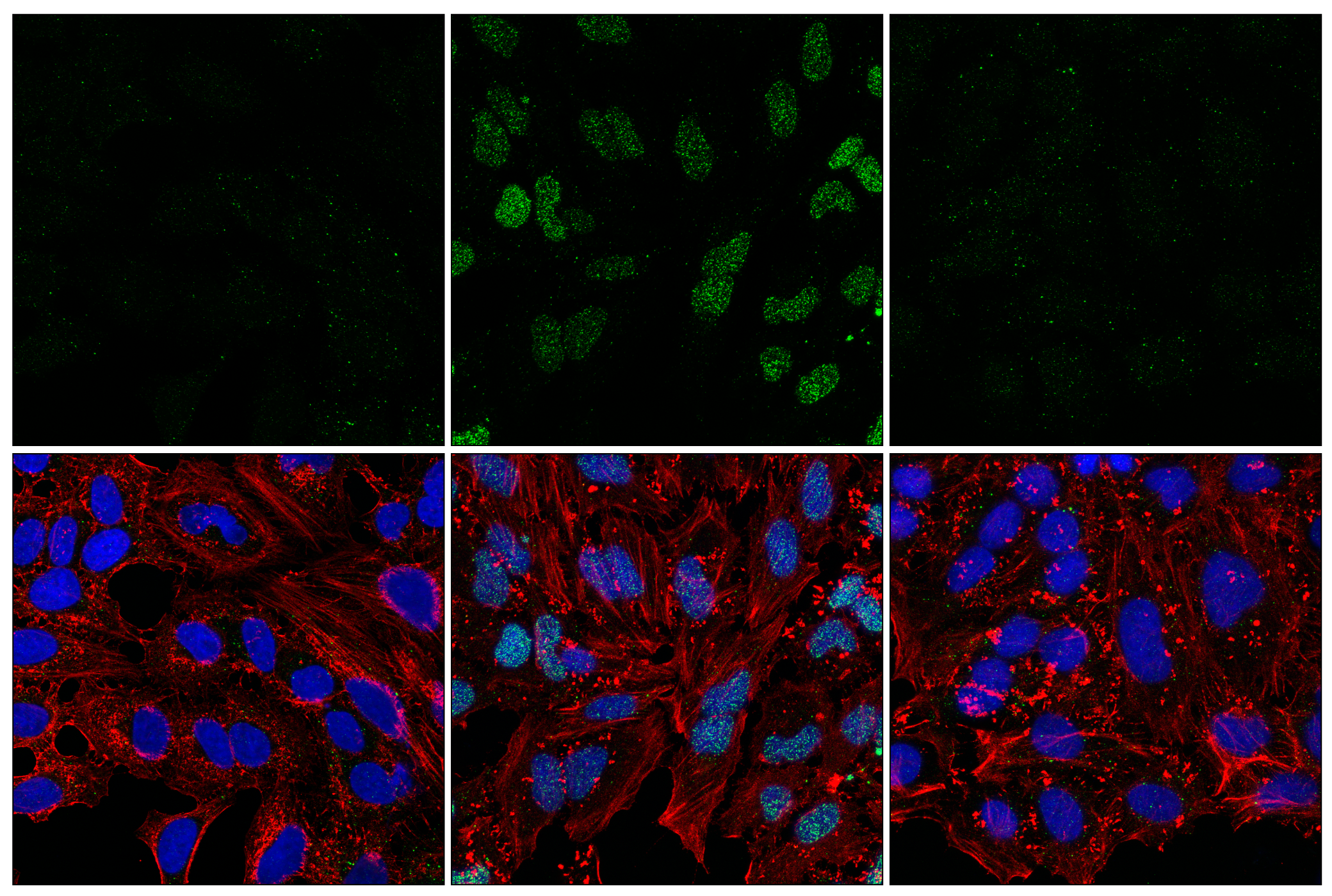 Immunofluorescence Image 1: Poly/Mono-ADP Ribose (D9P7Z) Rabbit mAb (BSA and Azide Free)