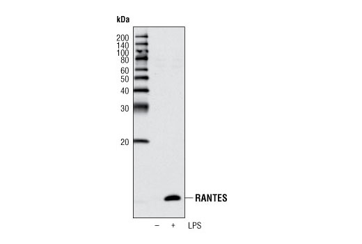 Western Blotting Image 1: CCL5/RANTES (P20) Antibody
