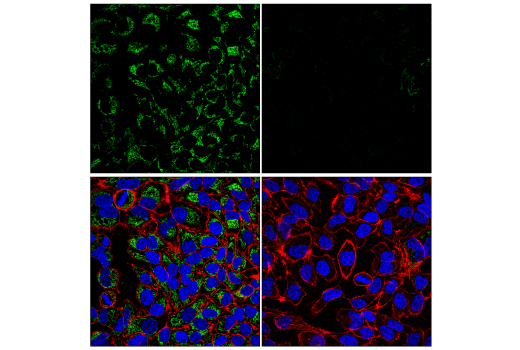 Immunofluorescence Image 1: MTX1 (E4O1L) Rabbit mAb