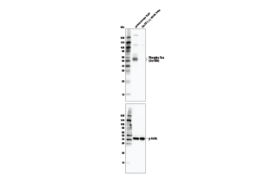 Western Blotting Image 1: Phospho-Tau (Ser199) Antibody
