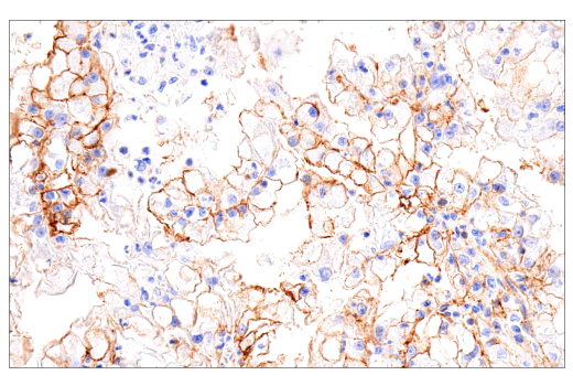 Immunohistochemistry Image 2: CD99 (PCB1) Mouse mAb