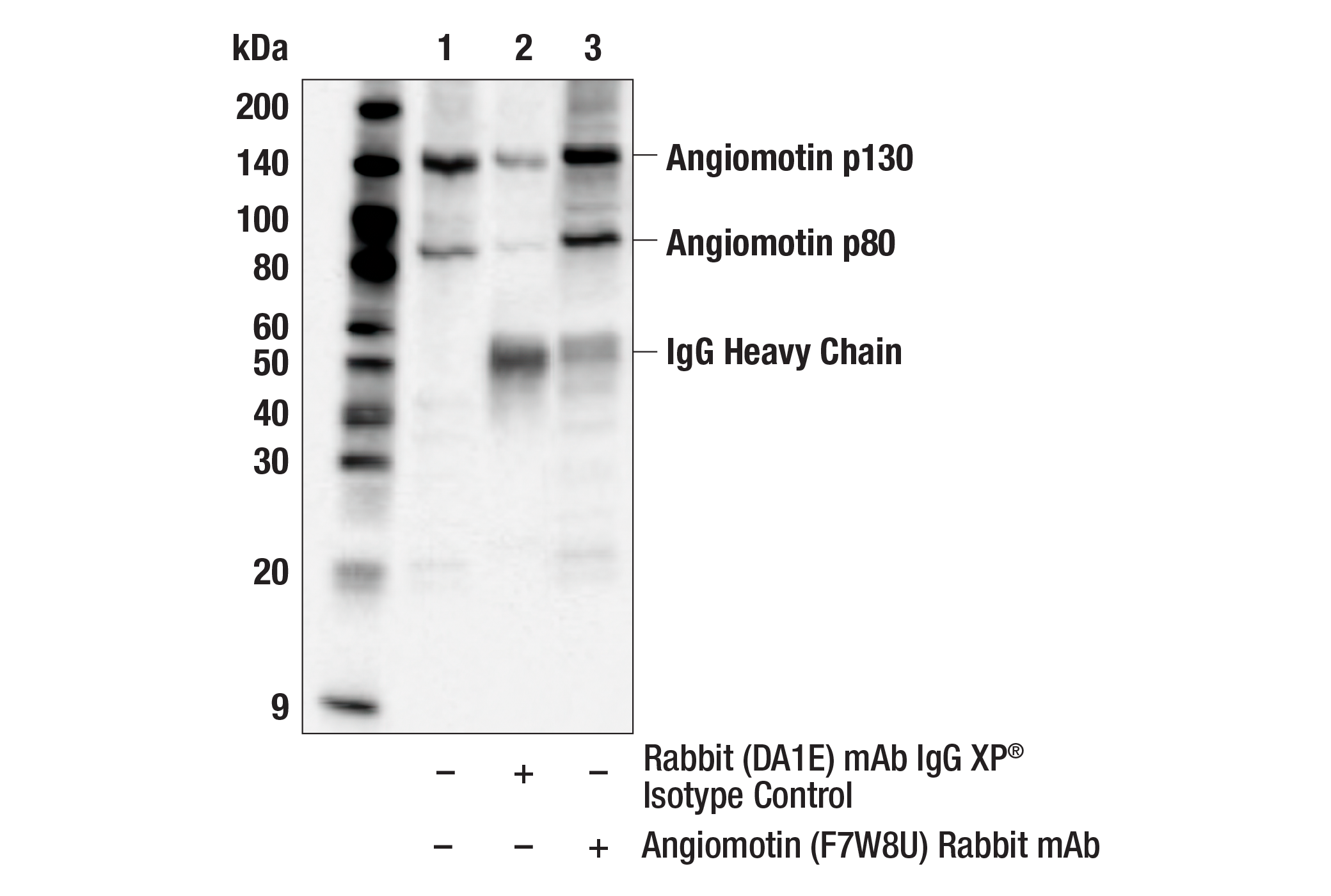 Immunoprecipitation Image 1: Angiomotin (F7W8U) Rabbit mAb
