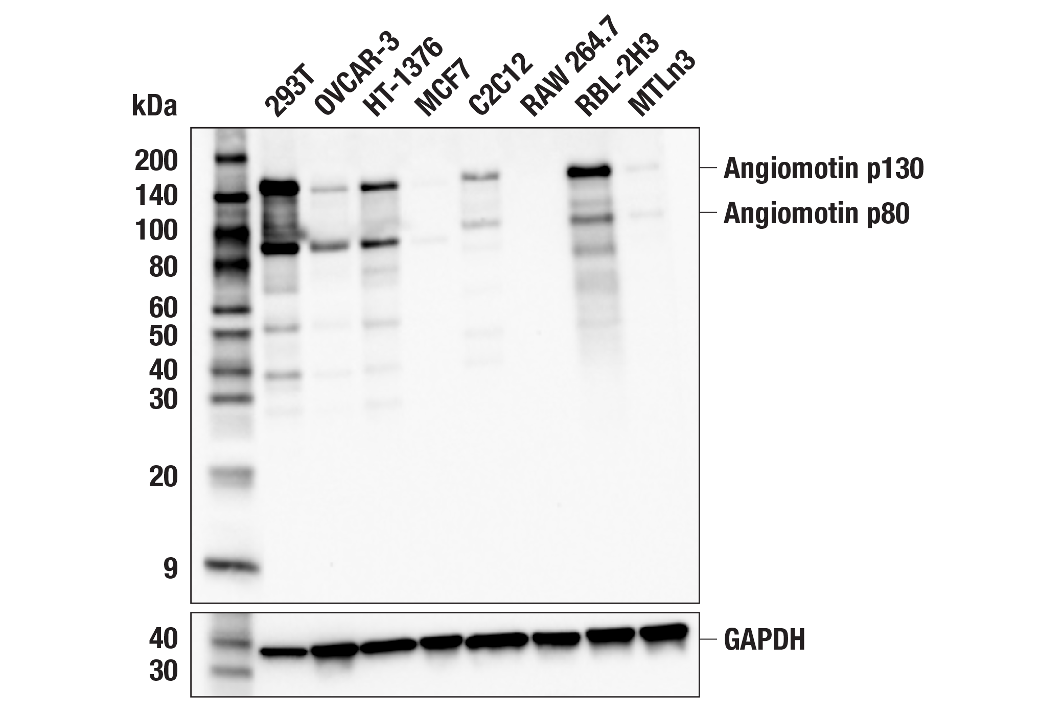 Western Blotting Image 1: Angiomotin (F7W8U) Rabbit mAb