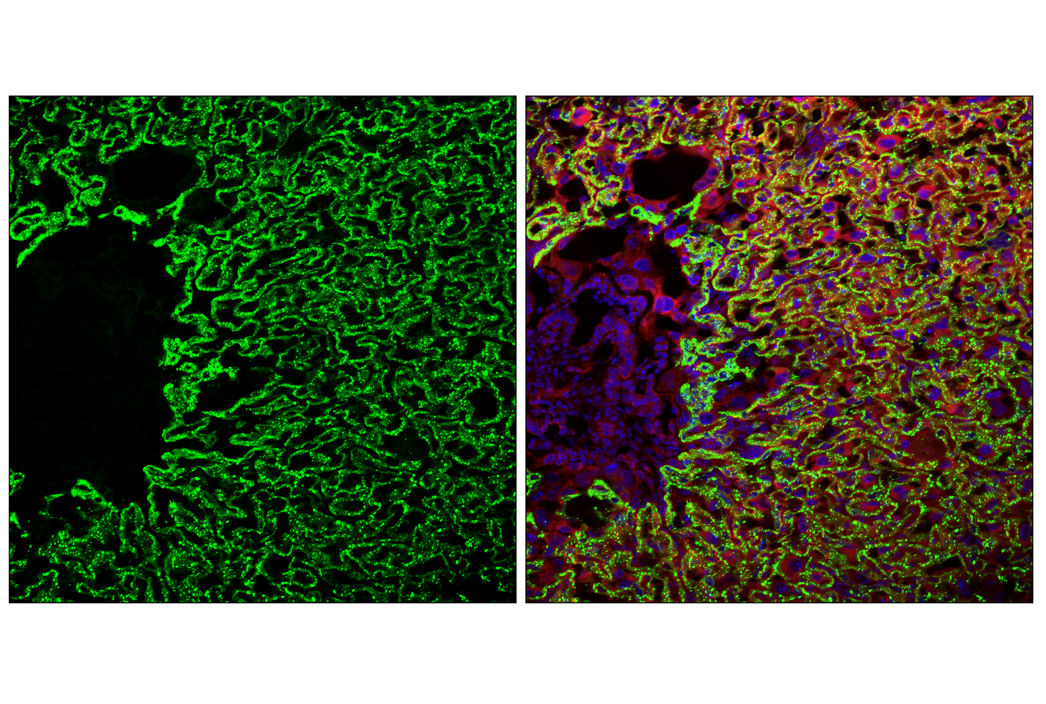 Immunofluorescence Image 1: Angiomotin (F7W8U) Rabbit mAb