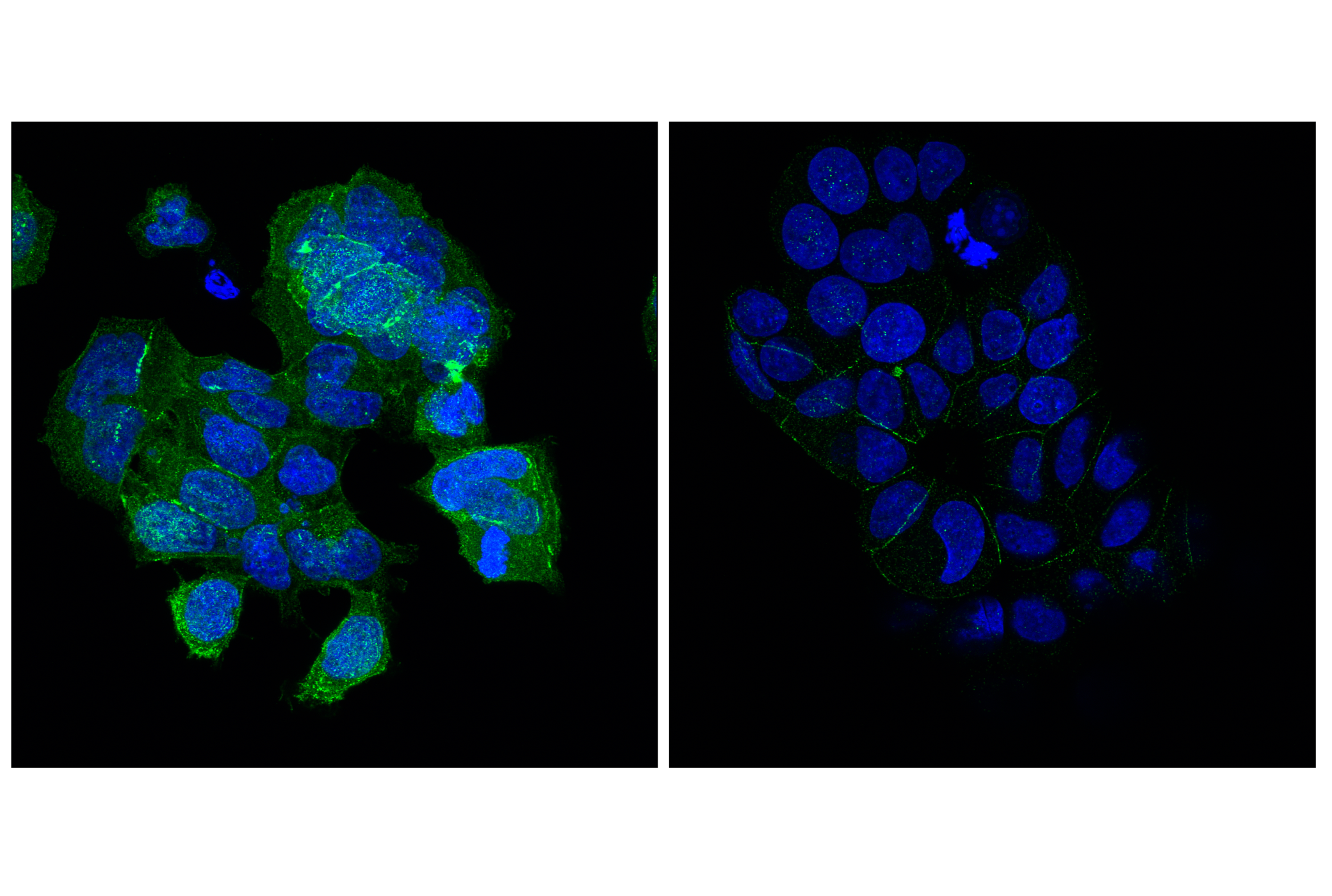 Immunofluorescence Image 2: Angiomotin (F7W8U) Rabbit mAb