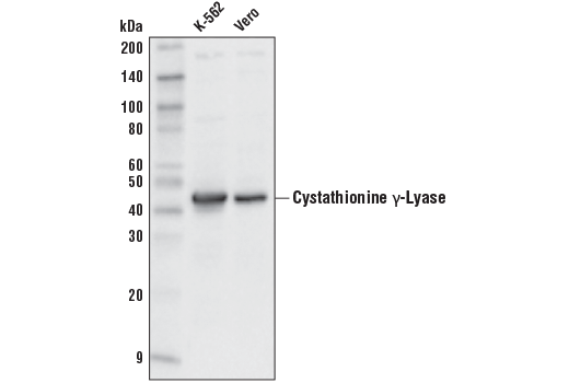Western Blotting Image 1: Cystathionine γ-Lyase (D4E9J) Rabbit mAb