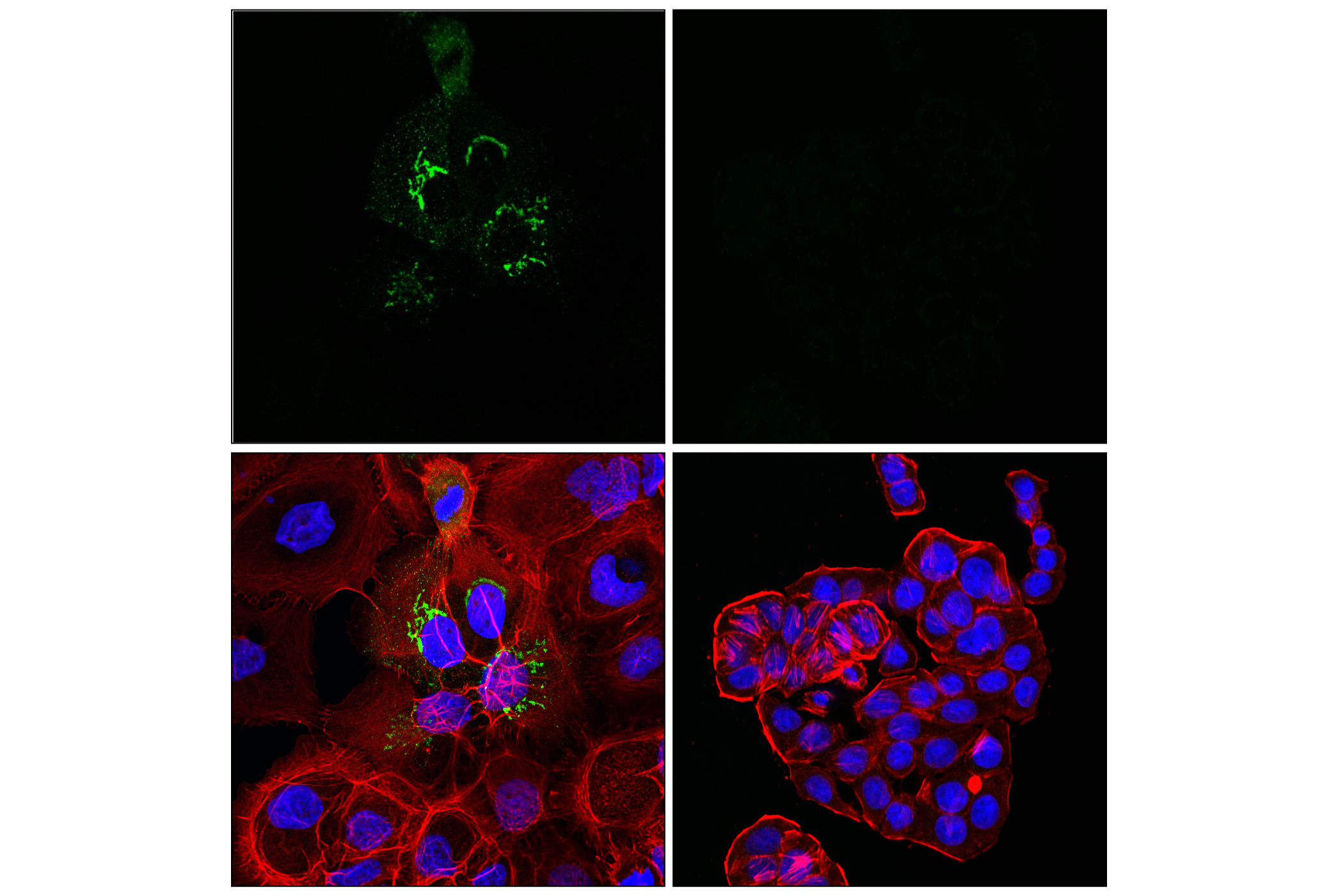 Immunofluorescence Image 1: MMP-1 (E8G4F) Rabbit mAb