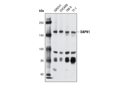 Western Blotting Image 1: DAPK1 Antibody