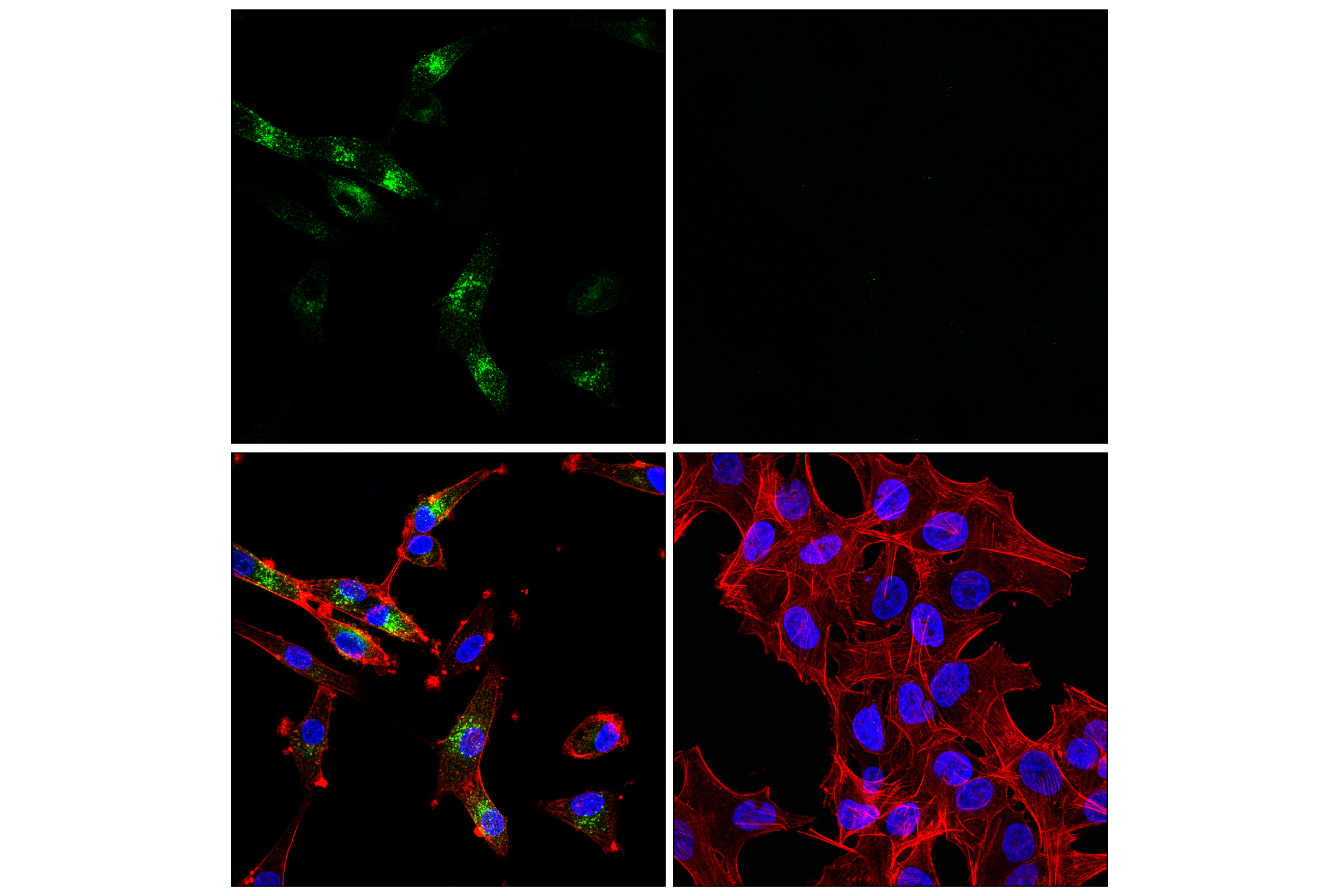 Immunofluorescence Image 2: EAAT3 (E1E6M) Rabbit mAb (BSA and Azide Free)
