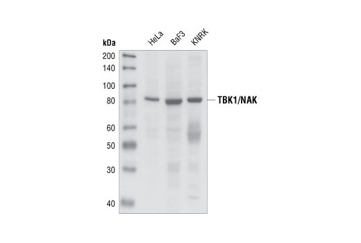 Western Blotting Image 1: TBK1/NAK Antibody