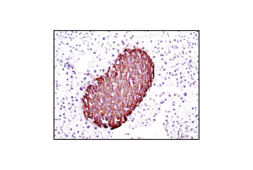  Image 11: Pancreatic Marker IHC Antibody Sampler Kit