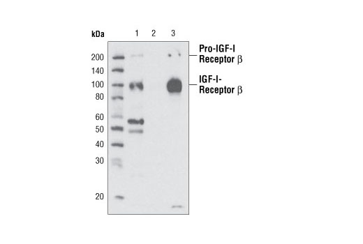 Immunoprecipitation Image 1: IGF-I Receptor β (111A9) Rabbit mAb